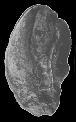 APNOV_o1.gif